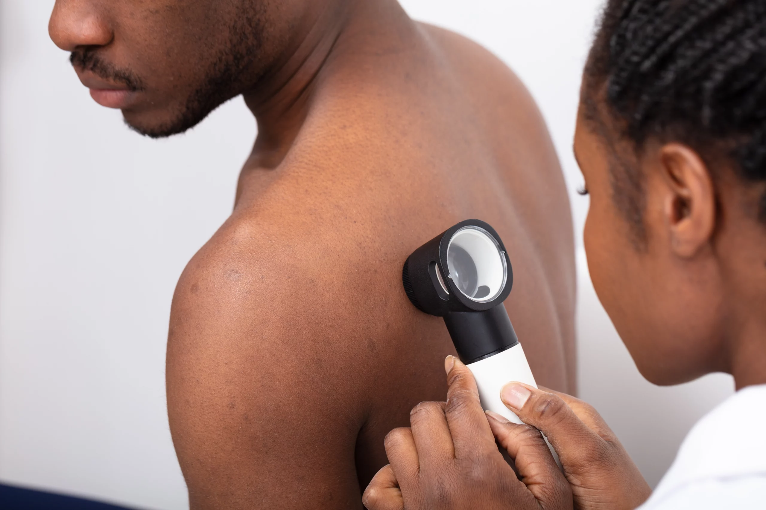 Doctor checking skin on man's back with dermatoscope