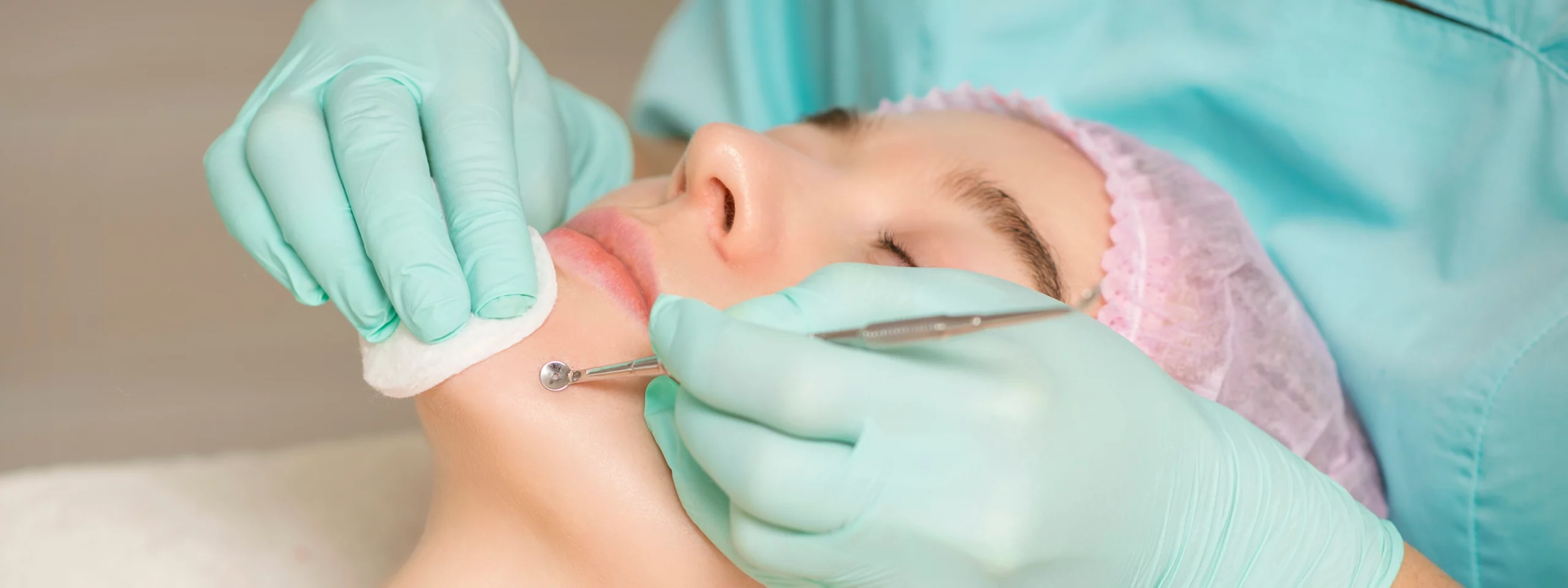 Esthetician removing blackhead on a woman's chin